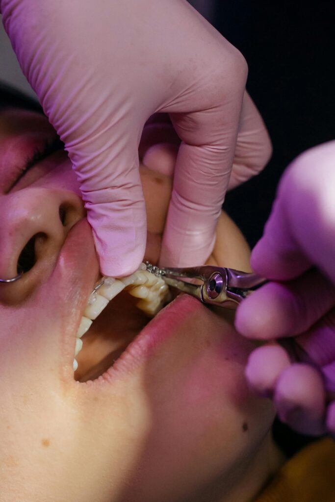 A detailed close-up of a dental procedure of braces tightening 
